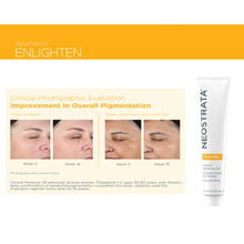 Load image into Gallery viewer, Neostrata Enlighten Pigment Lightening Gel 40g Before and After Photo