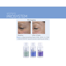 Load image into Gallery viewer, Neostrata ProSystem Rejuvenating Peels 30ml  1