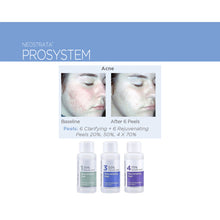 Load image into Gallery viewer, Neostrata ProSystem Rejuvenating Peels 30ml
