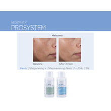 Load image into Gallery viewer, Neostrata ProSystem Rejuvenating Peels 30ml