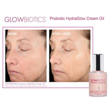 Load image into Gallery viewer, Glowbiotics Probiotic Hydraglow Cream Oil 1oz before and after photos