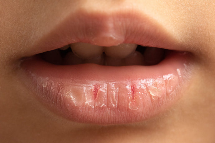 Ultimate Guide to Smooth and Hydrated Lips