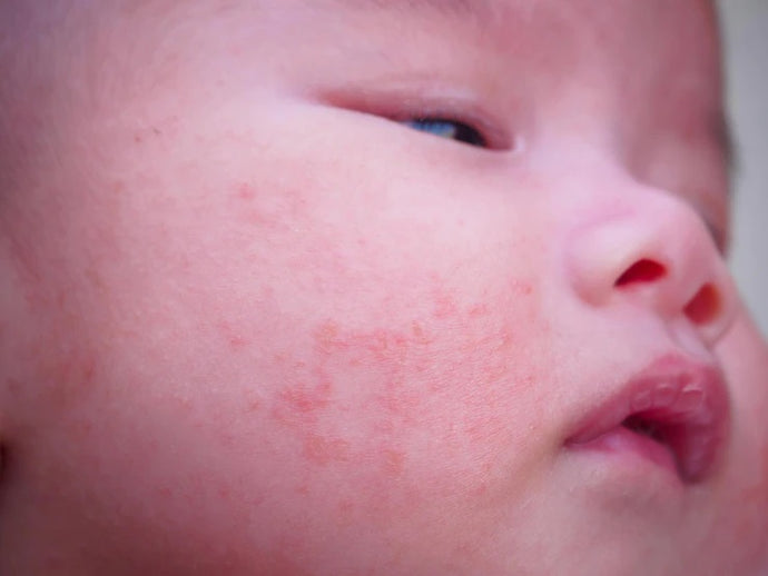 Care Tips for Baby’s Sensitive Skin