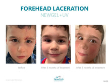 Load image into Gallery viewer, NewGel+ UV

