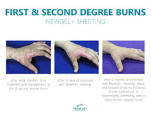 Load image into Gallery viewer, NewGel+ Sheet
