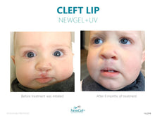 Load image into Gallery viewer, NewGel+ UV
