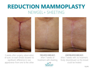 NewGel+ Sheet
