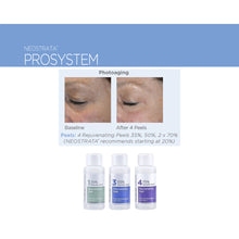 Load image into Gallery viewer, Neostrata ProSystem Rejuvenating Peels 30ml  1
