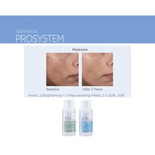 Load image into Gallery viewer, Neostrata ProSystem Rejuvenating Peels 30ml 
