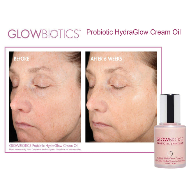 Glowbiotics Probiotic Hydraglow Cream Oil 1oz before and after photos